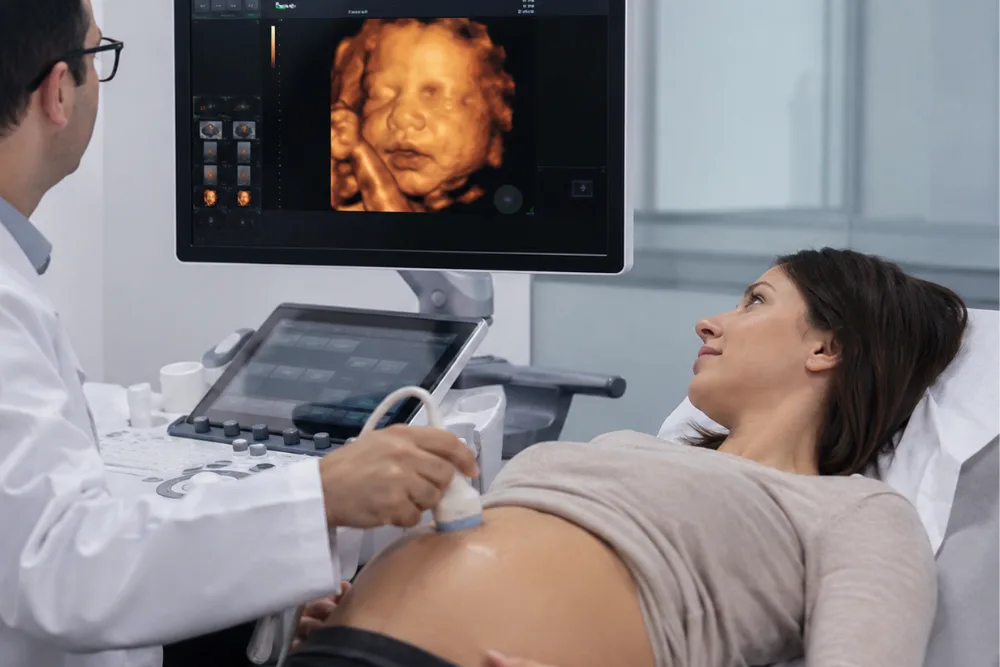 Ultrasonido 4D gender reveal